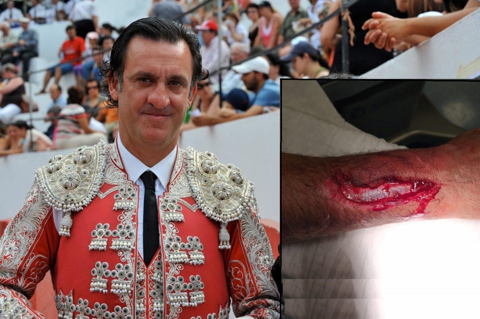Bandarilheiro tomarense ferido durante espetáculo taurino bandar 7714083 6990771951048327168 n