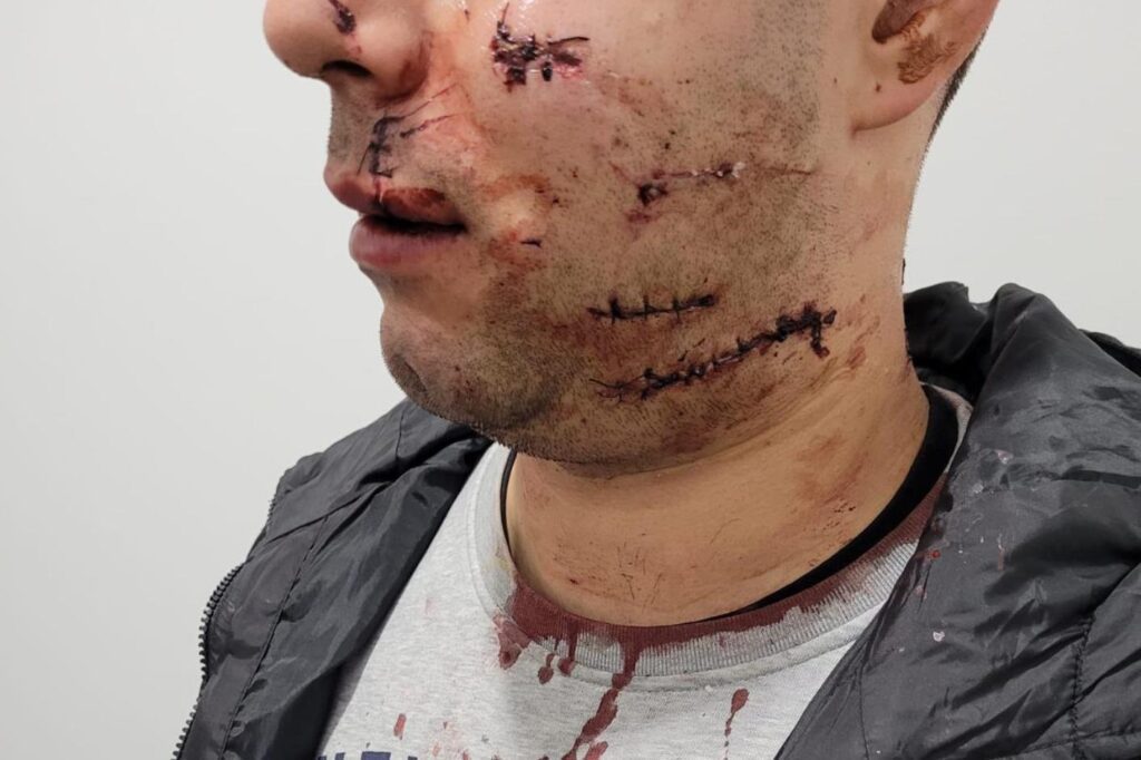 Homem que agrediu militar da GNR ficou em liberdade IMG 20230129 WA0008 Copia