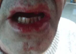 agressao WhatsApp Image 2024 02 21 at 11.11.15