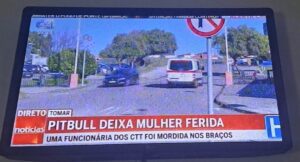 Jovem carteira de Tomar atacada por Pitbull ficou em estado grave IMG 20250801 WA0003