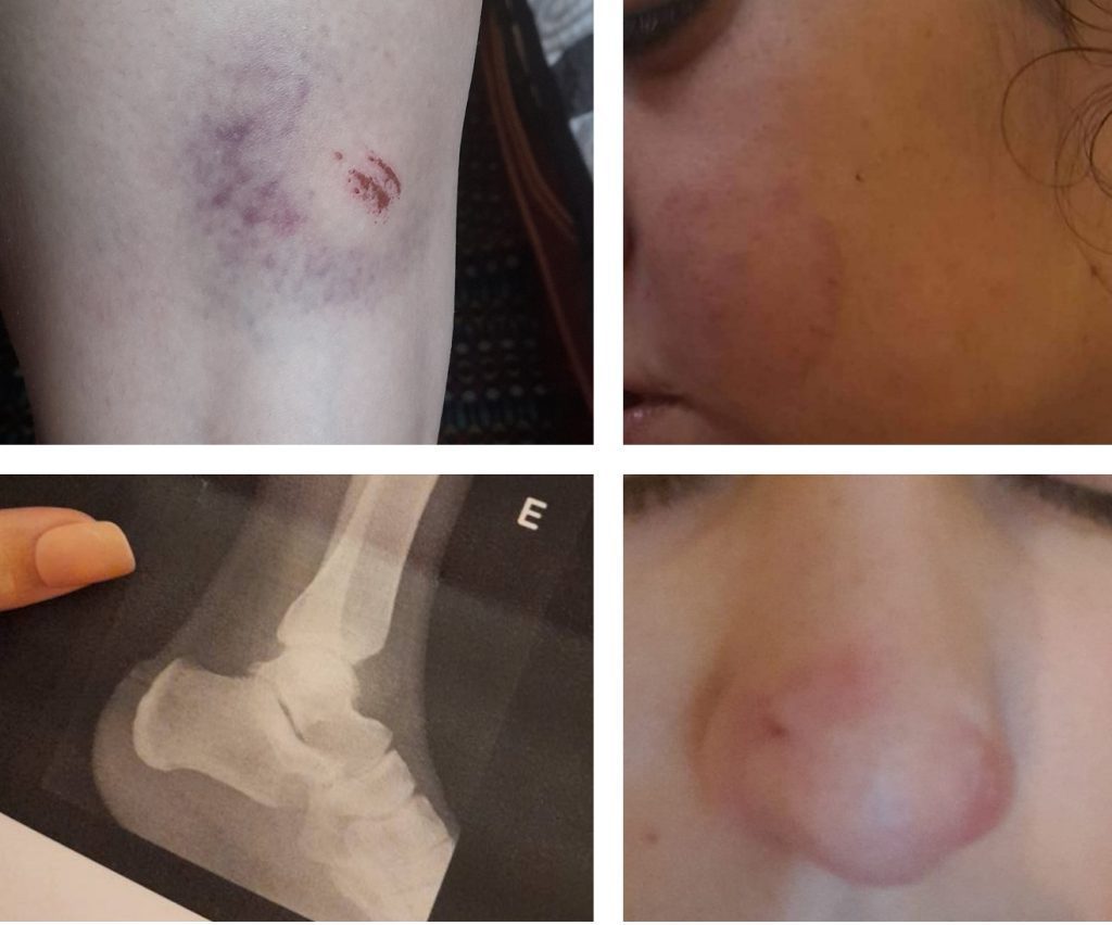 violencia domestica